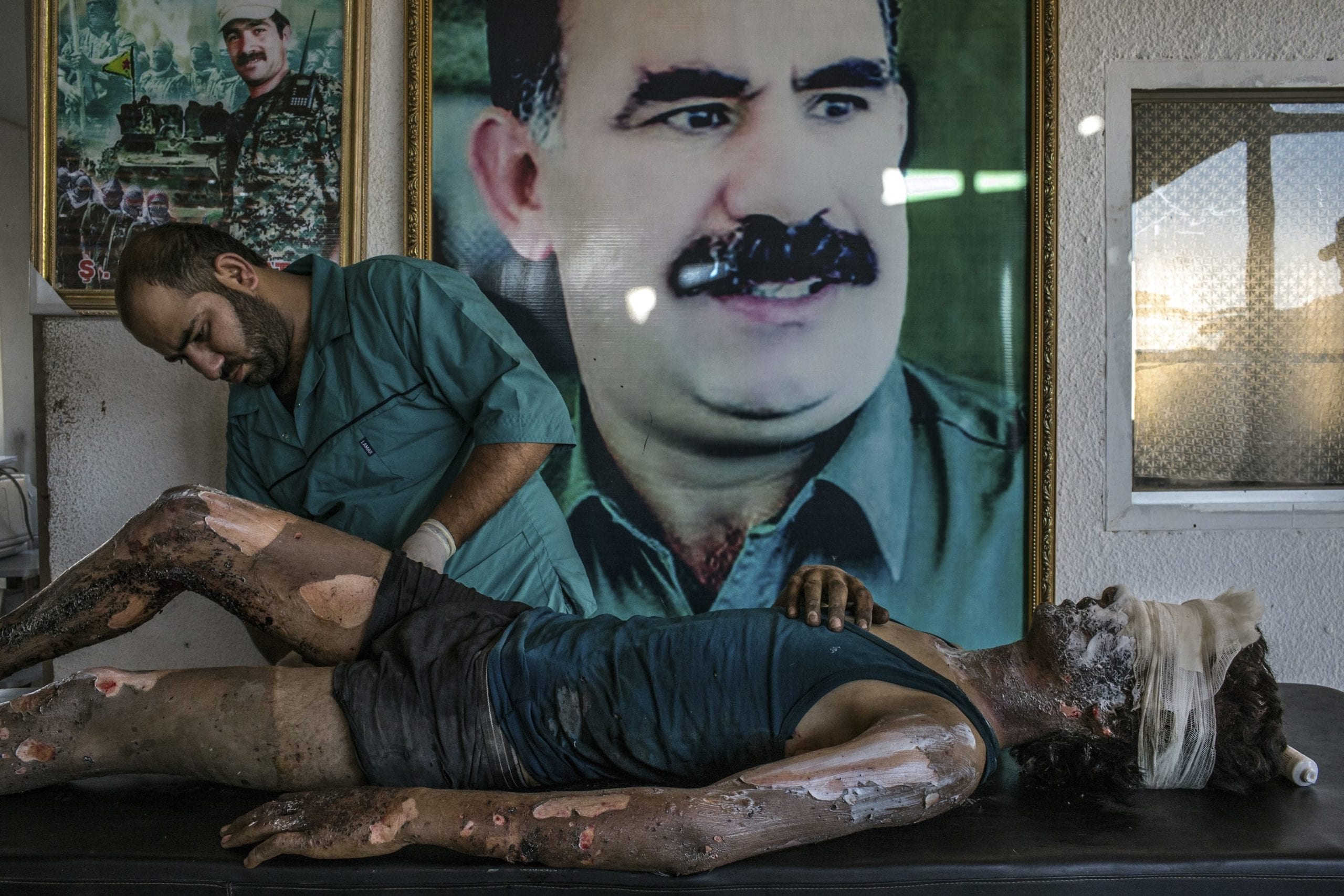 Hasaka, Syria - August 1, 2015. A doctor rubs ointment on the burns of Jacob, 16, in front of a poster of Abdullah Ocalan, center, the jailed leader of the Kurdistan Workers' Party, at a YPG hospital compound on the outskirts of Hasaka. According to YPG fighters at the scene, Jacob is an ISIS fighter from Deir al-Zour and the only survivior from an ambush made by YPG fighters over a truck alleged to carry ISIS fighters on the outskirts of Hasaka. Six ISIS fighters died in the attack, 5 of them completely disfigured by the explosion (c) Mauricio Lima for The New York Times