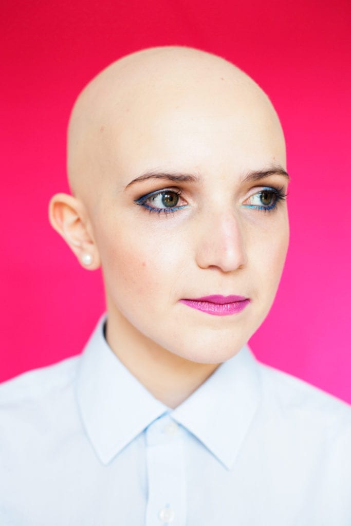 Emily from the series Unfading featuring women affected by the auto-immune hair loss condition alopecia.