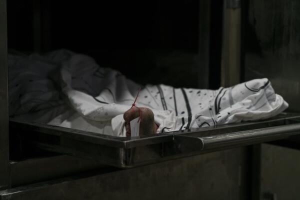 This woman was found dead on the outskirts of Erbil. According to the local police report she is over 40 years old, married, and the victim of a murder. She was taken to the location with her house dress on, which indicates that the murderer might have known her. Police have kept her body for over six months, waiting for it to be identified, but so far no one has claimed her body or shown any interest in helping the authorities find out who she is.