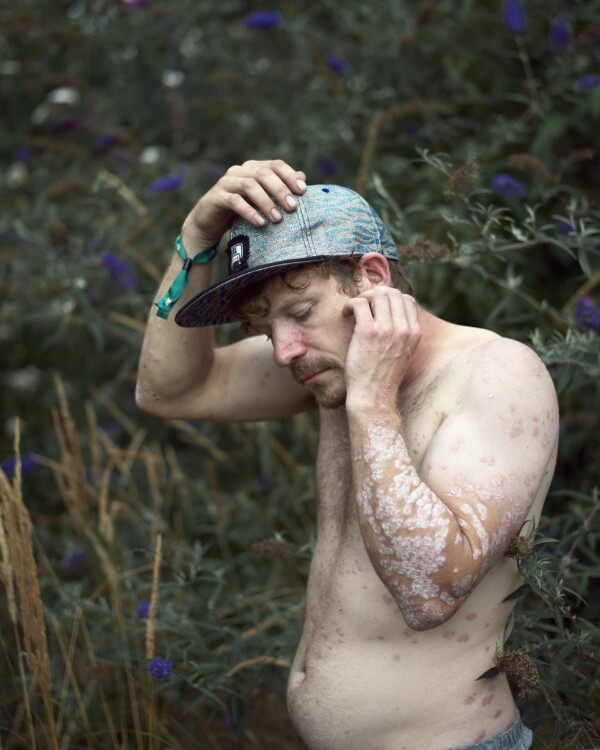 Todd, Brighton, East Sussex