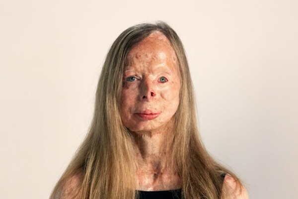 End Acid Violence, London