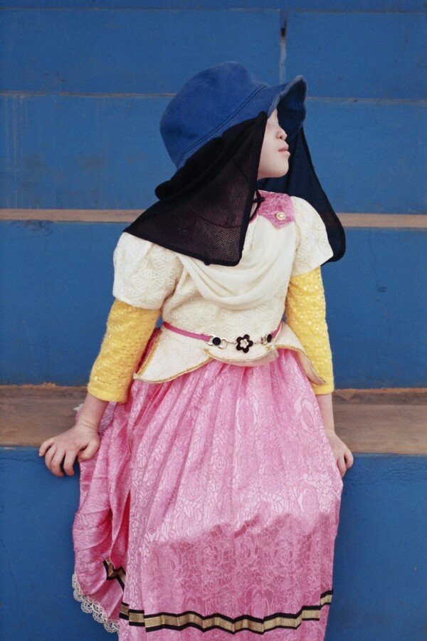 International Albinism Day, Dodoma, Tanzania