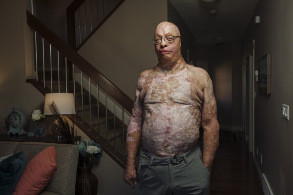 20 Seconds - Edmonton, Canada